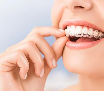 Cosmetic Dentistry Cosmetic Dentistry