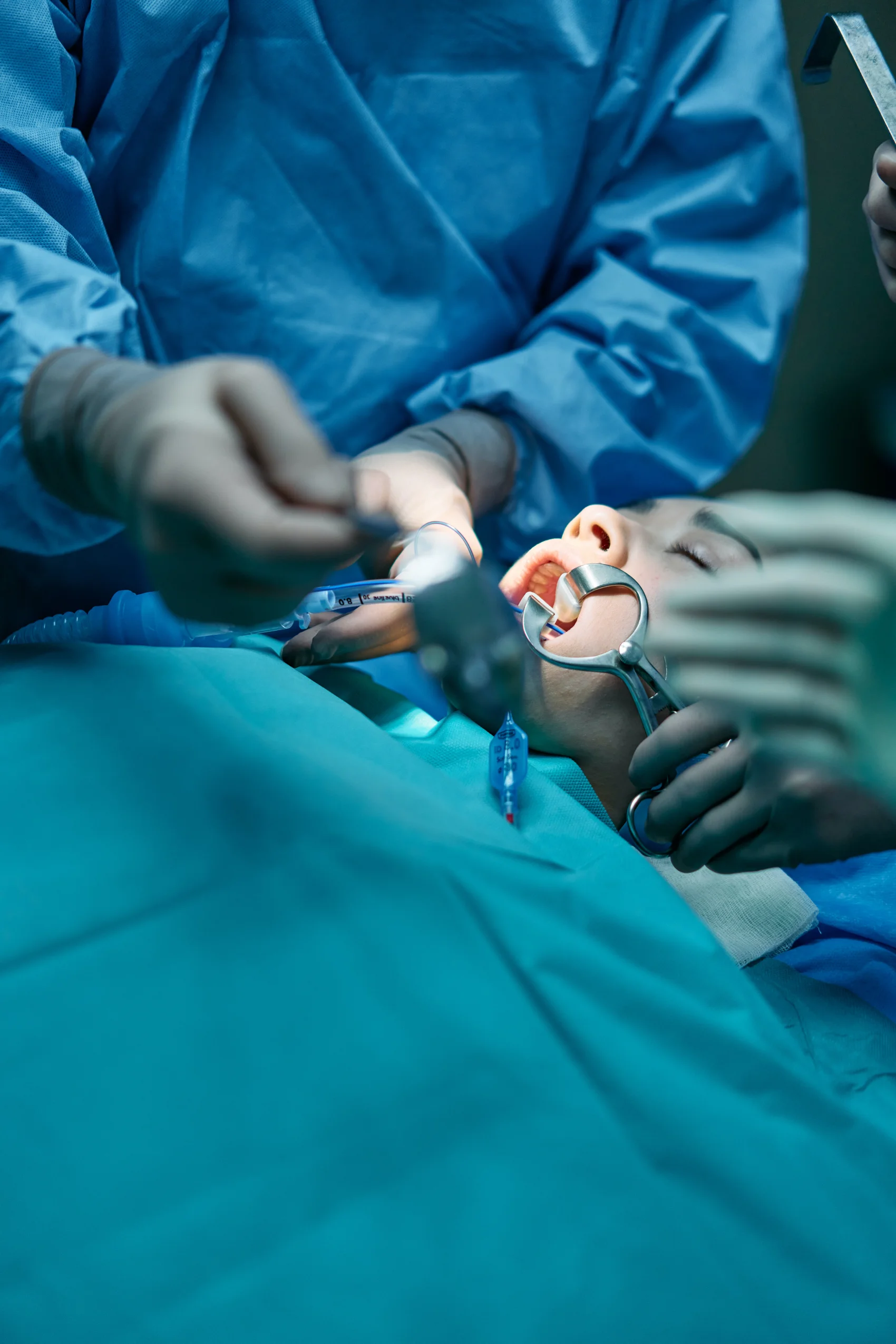 Oral Surgery Oral Surgery